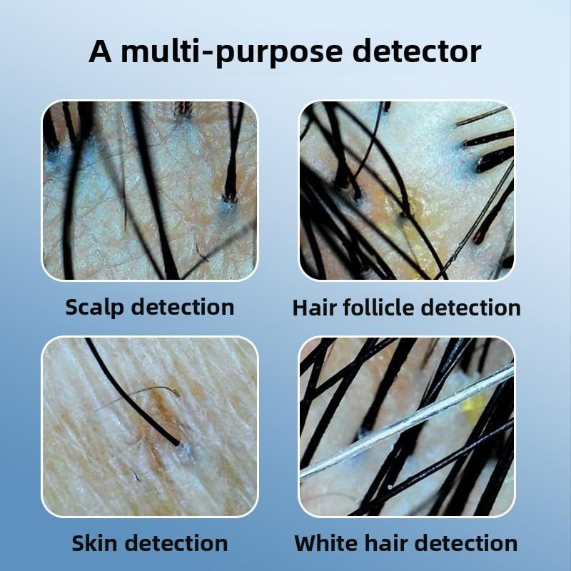 Scalp Detector with Monitor, Hair Analysis System, Digital Display Screen Diagnosis MultiFunctional Hair Follicle Skin Analyserجهاز كشف فروة الرأس مع شاشة، نظام تحليل الشعر، شاشة عرض رقمية لتشخيص بشرة بصيلات الشعر متعدد الوظائف