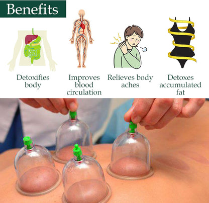 Professional Chinese Acupoint Cupping Therapy Sets Portable Suction Hijama Cupping Set 24 PICS